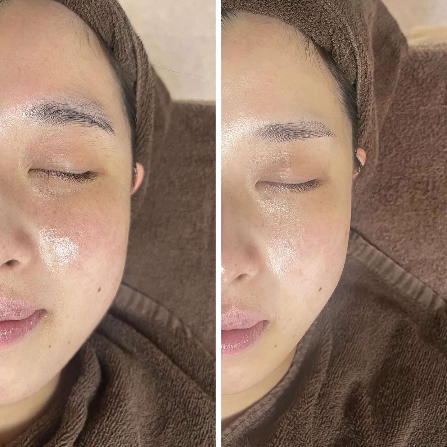 シェービング×肌に合うスキンケア