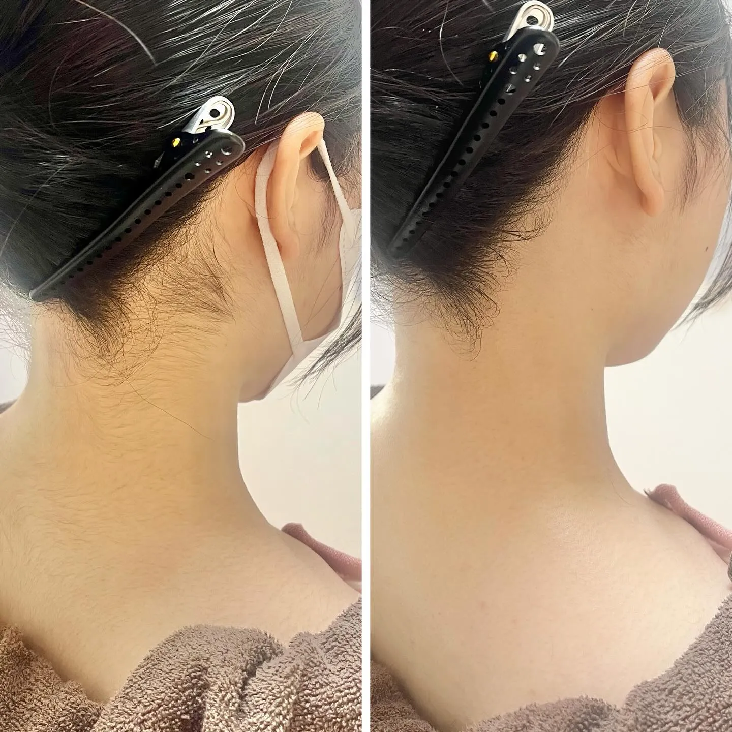 大切な節目にシェービング晴でケアを