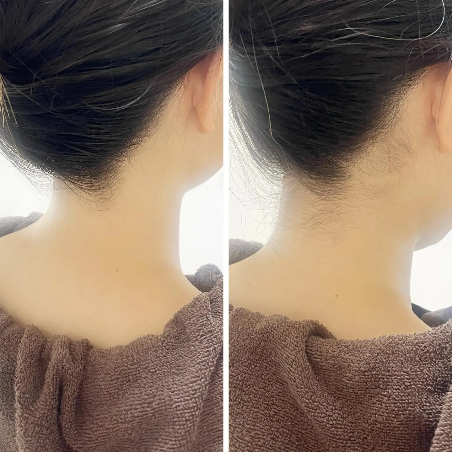 お肌のケアは『秋』に。