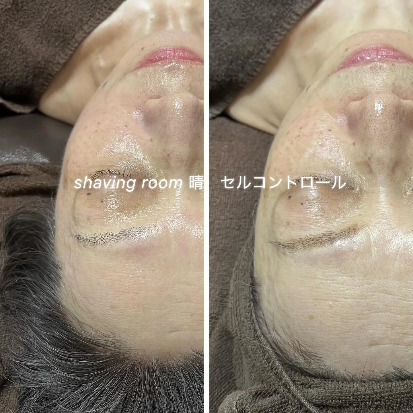 正しいハーブピーリング とは